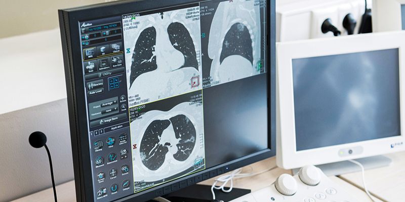 Neural network to help doctors simultaneously identify up to 10 pathologies using CT scans