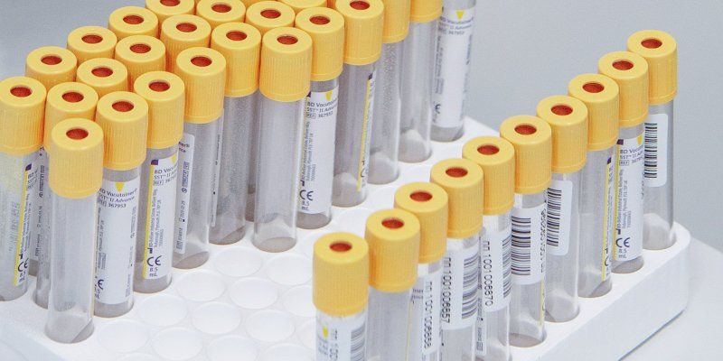 Более 200 тысяч анализов на коронавирус сделали за месяц в Москве