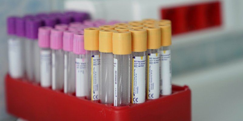 В Москве зарегистрировано самое низкое число новых случаев COVID-19 в августе