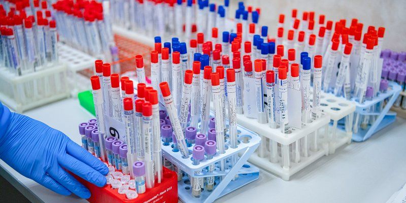 Медработников в Москве проверяют экспресс-тестами на иммунитет к COVID-19
