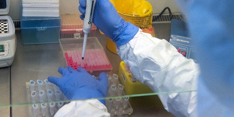 Пациентов с внебольничной пневмонией необходимо тестировать на коронавирусную инфекцию