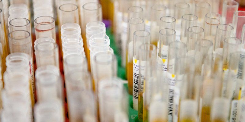 Ежедневно в России исследуется порядка 36 тысяч проб на коронавирусную инфекцию
