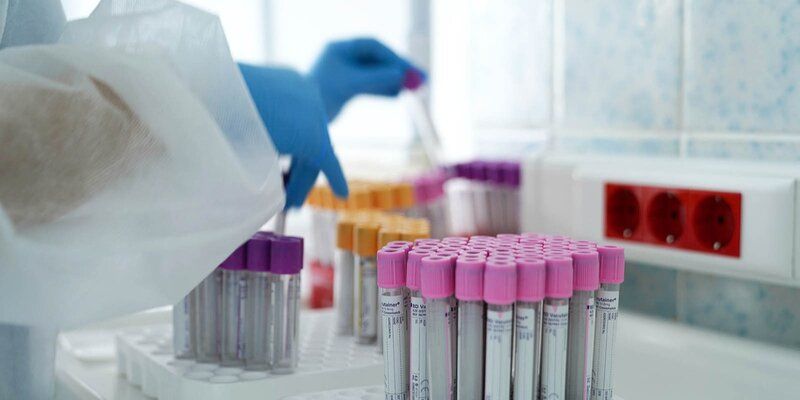 Сергей Собянин: У 89,3 процента заболевших в Москве выявляют новый мутированный штамм